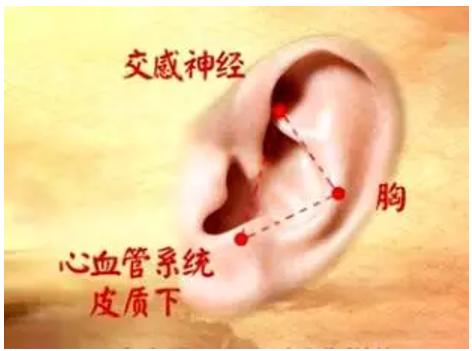 耳穴压豆治疗冠心病论文,冠心病胸胀痛买什么耳穴贴