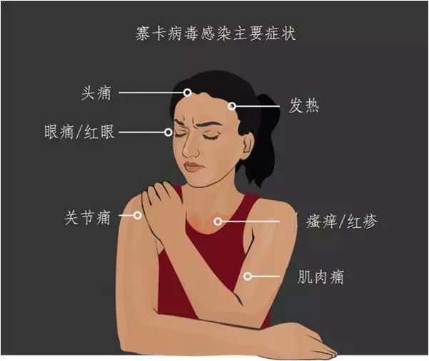 寨卡病毒引发致命并发症,寨卡病毒会导致胎儿出现什么情况