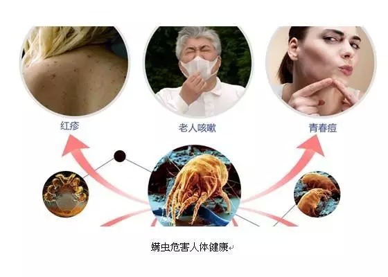 不用晒被子就能消灭螨虫,被褥上的螨虫真的很可怕吗