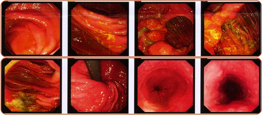 同为同龄人命运各不同,同为双胞胎命运却不同