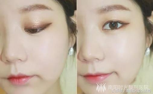 南阳时光整形图片,南阳时光整形美容