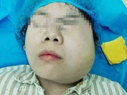 孕妇智齿发炎小偏方,孕妇智齿引起的牙龈发炎