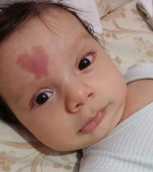 胎记的意义是什么,脚踝长胎记有什么意义