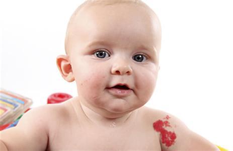 胎记的意义是什么,脚踝长胎记有什么意义