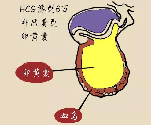 吃黄体酮保胎失败需要住院吗,承担宫外孕和保胎失败风险