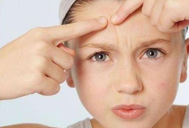 脸上长痘痘痘印怎么快速消除,男生脸上痘印痘坑怎么快速消除