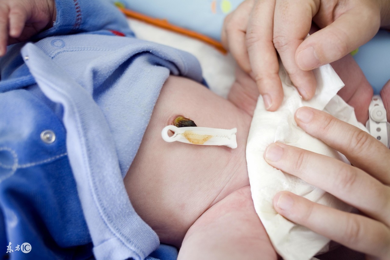 新生儿脐带护理的正确方法,婴儿脐带出血怎么护理视频