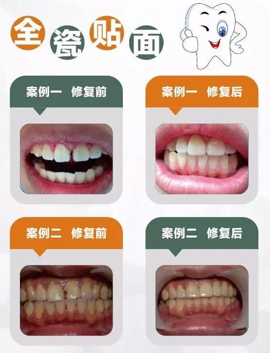 涵江医院口腔科哪个医生好,涵江医院口腔科吴建明怎么样