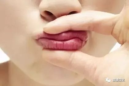 嘴唇干燥是什么病的预兆,嘴唇干燥查什么