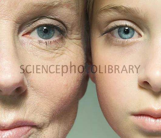 老年女性高血压160严重吗,老年女性高血压患者尿酸值384算高吗