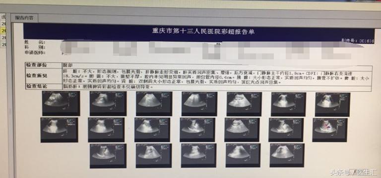 头晕夜尿多身上痒是什么原因,皮肤瘙痒是肾病的表现吗