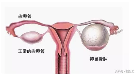 肚子疼别乱吃止痛药,肚子疼的受不了通常都是什么症状