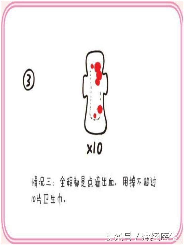 正常月经的5个标准赶紧对照一下,如何知道自己的月经量是否正常