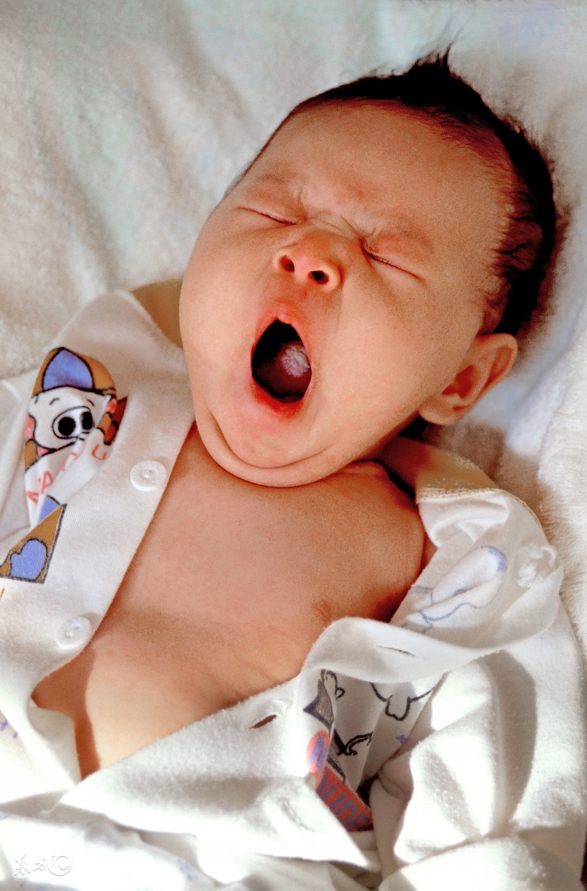 怎么预防急性湿疹变成慢性湿疹,二个月宝宝怎样预防湿疹的发生