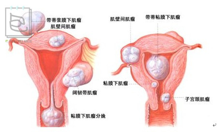 北美红宝石的蔓越莓,北美的红宝石蔓越莓