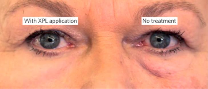 中国学者一流发现、水星凌日、抚平皱纹的神奇“面膜”｜每周科技