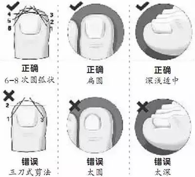 小脚趾甲黑了怎么回事,小脚趾甲黑是怎么回事