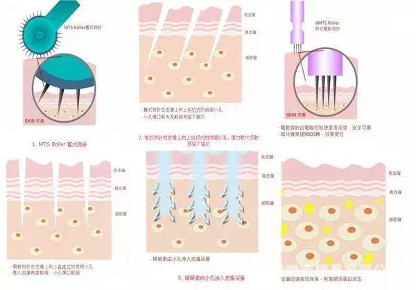 李沁活动把自己P白了N个度，这种肤色不均是不是没救了？