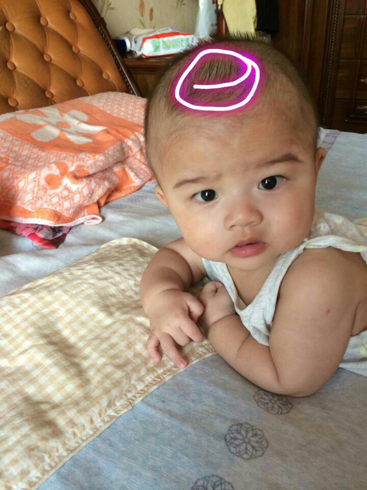 新生儿头顶囟门不能碰,宝宝的囟门是不是绝对的不能碰