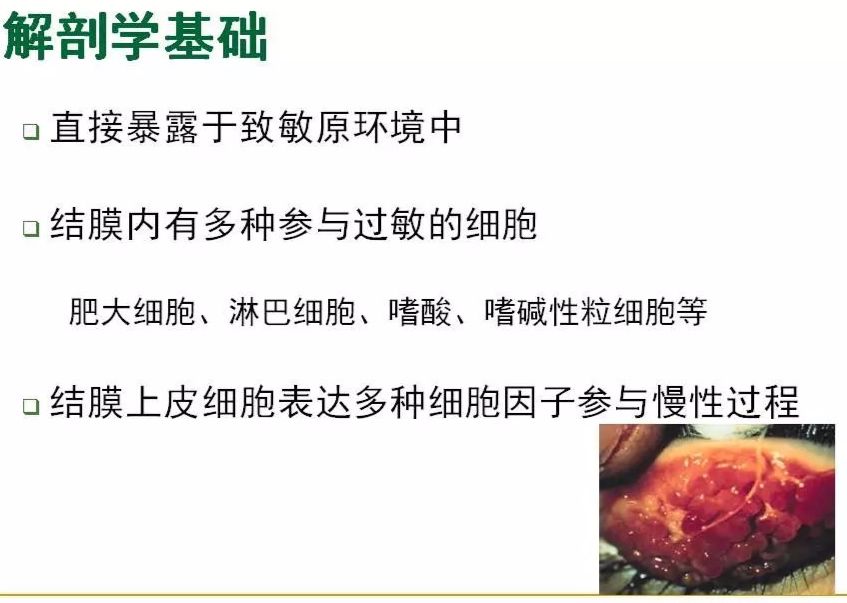 眼周过敏中医治疗,眼周过敏的症状图片