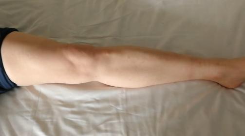 侧副韧带前叉断裂康复训练,前叉交叉韧带重建后多久能脱拐