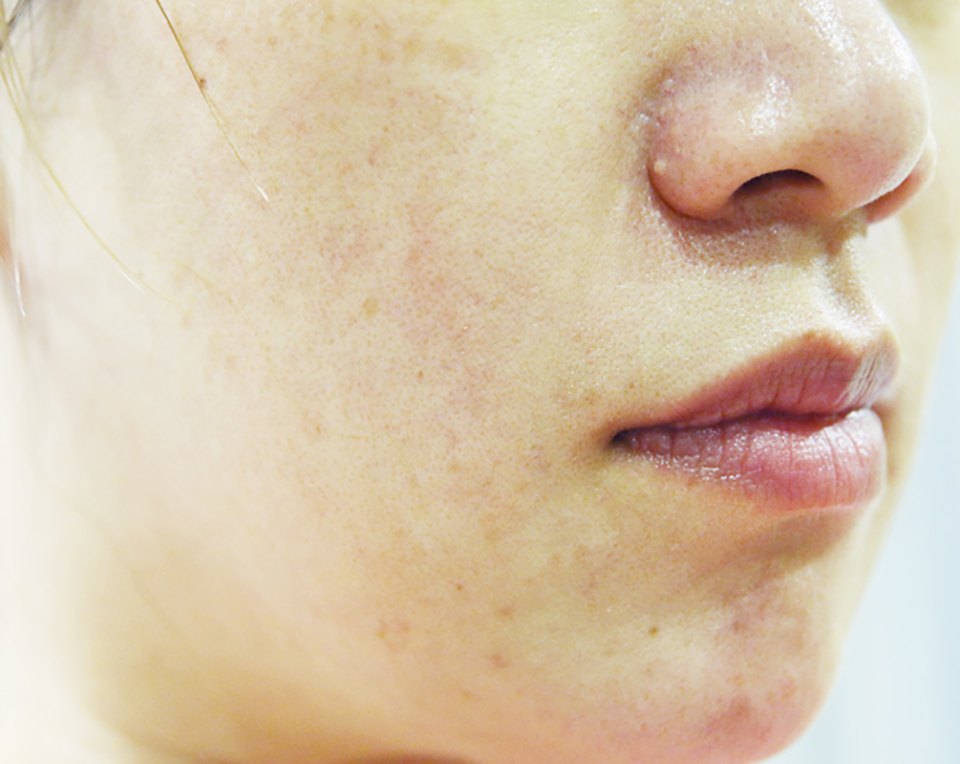 什么牌子的芦荟胶纯度高,自然共和国芦荟胶测评