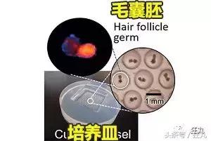 日本研究秃顶,日本教授秃头研究