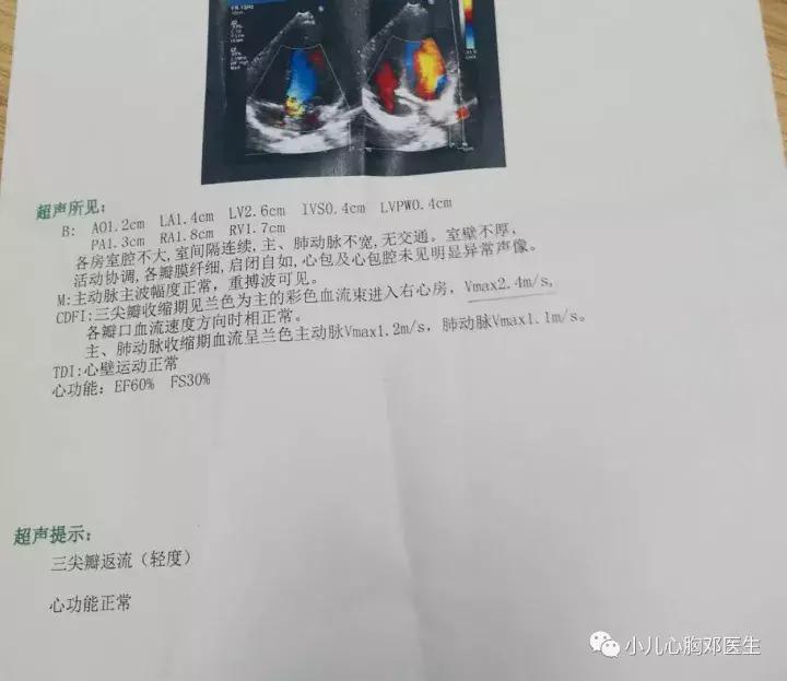 儿童生理性瓣膜反流原因,减少瓣膜反流药物