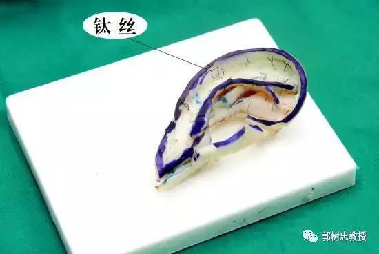 我是如何造耳朵的（十二）耳朵的保养