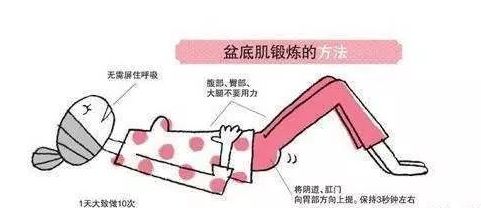 快来看看，你的盆底肌力是否及格？