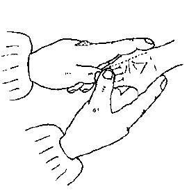 宝宝面色萎黄是什么原因,宝宝消瘦面黄是什么原因