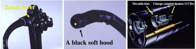 内镜检查痛苦吗,内镜检查是怎么做的