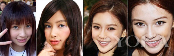 大变脸原来整牙才是高颜值,女星整牙都是越整越美