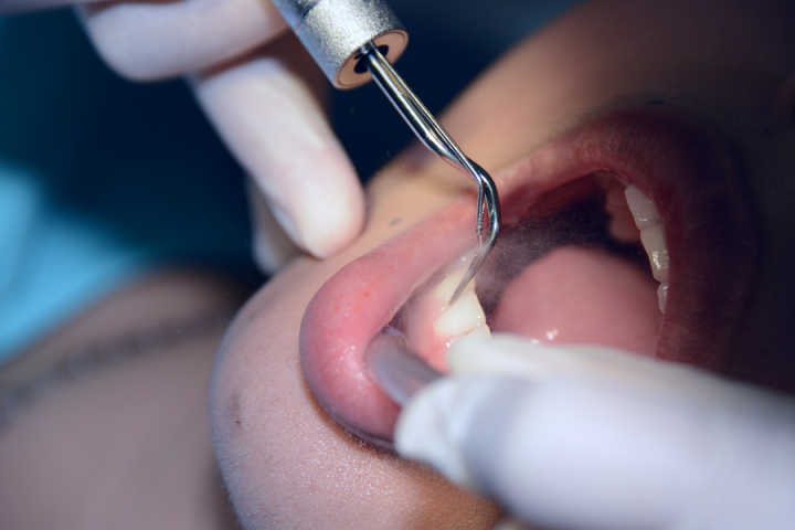 牙龈肿痛吃晚饭可以吃什么,胃口不舒服也能引起牙龈肿痛吗