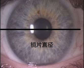 隐形眼镜推荐优瞳,隐形眼镜瞳距怎么选