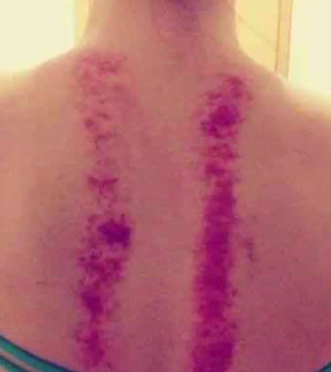 阿娇刮痧,阿娇刮痧养生视频