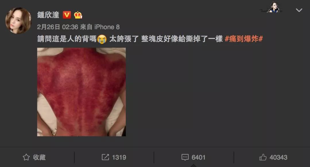 阿娇刮痧,阿娇刮痧养生视频