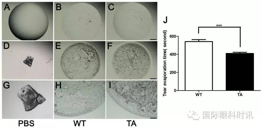 角膜会2016李炜教授:EDA基因突变鼠:一种新的睑板腺功能障碍相关性干眼动物模型