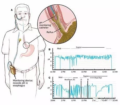 你知道你的胃有多强吗,你知道你的胃长什么样吗