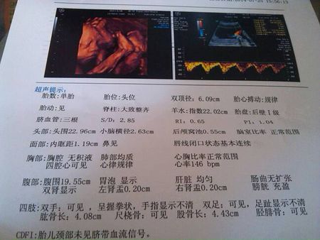 孕妈怀孕后羊水是怎样形成的,孕妈妈收藏