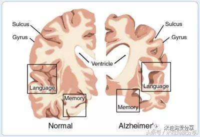 dha能让宝宝更聪明这是真的吗,dha吃了真的可以变聪明吗