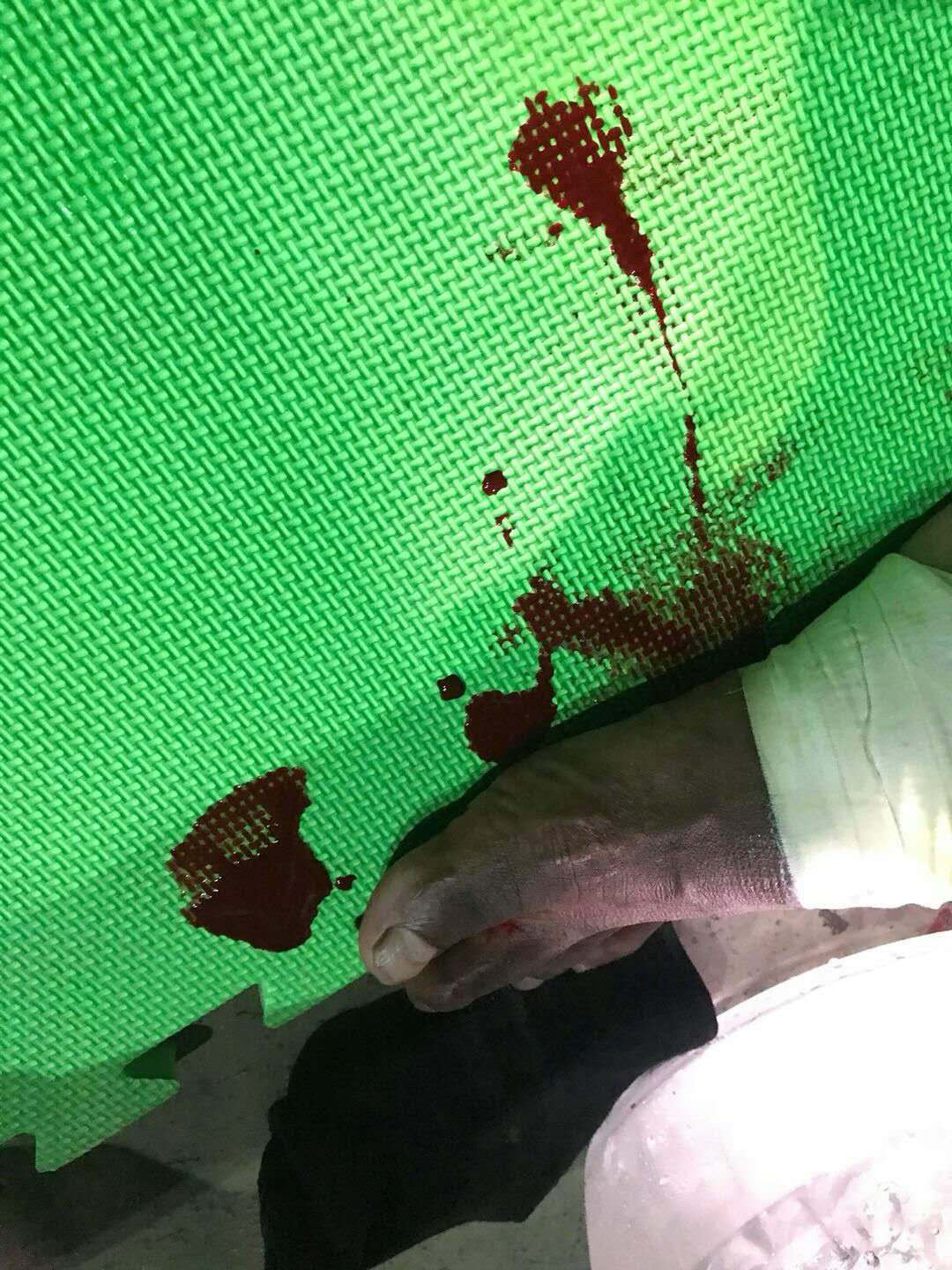 播求头破血流的比赛,播求被扫腿比赛