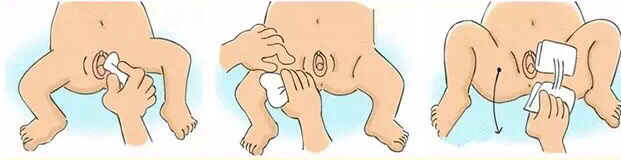 出生一周内的新生儿护理,准妈妈学习育婴培训班