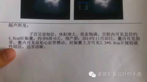 孕育小课堂,孕育学堂