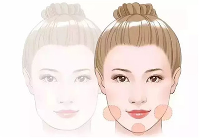 脸盘大做什么医美,脸盘大怎么样修容