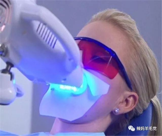 牙齿美白tips,变美第一步美白牙齿