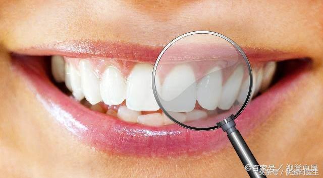 牙齿变白最有效的方法学生党,去口臭口气清新黄牙变白的小方法
