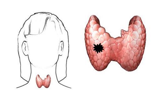 甲府事件有哪些,甲府市在哪里