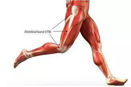 髂胫束疼艾灸哪些穴位呢,髂胫束综合征是哪里疼