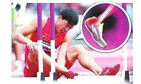 有的人为了残奥会去截肢,有些情况为什么要截肢